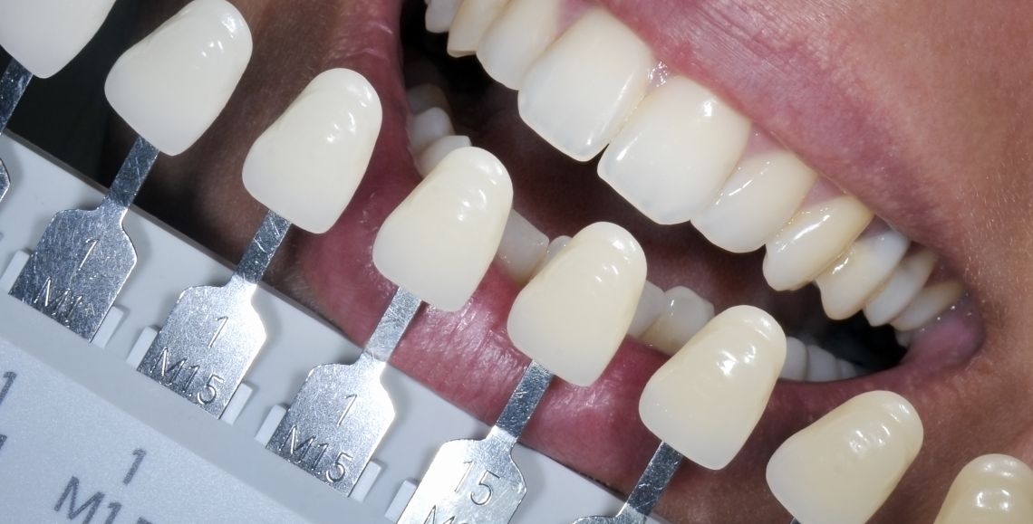 Ultimate Teeth Whitening Packages
