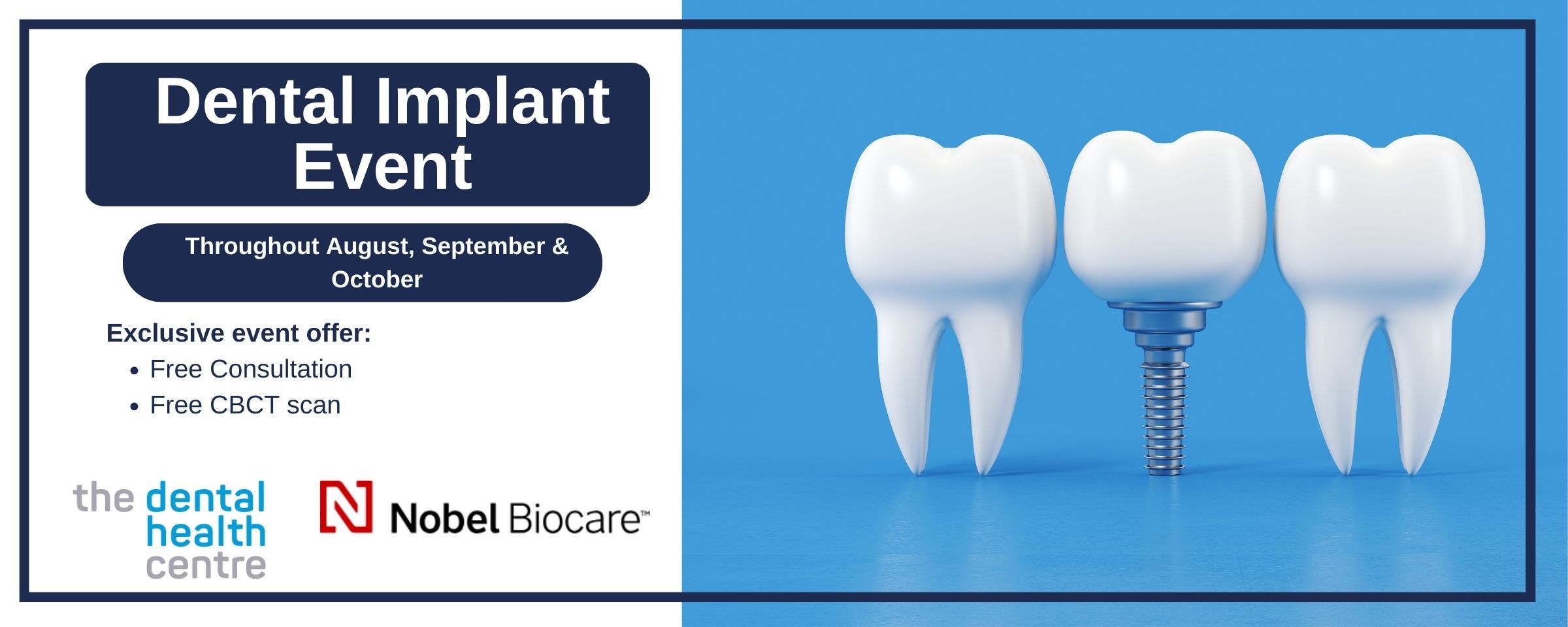 Dental Implant Event