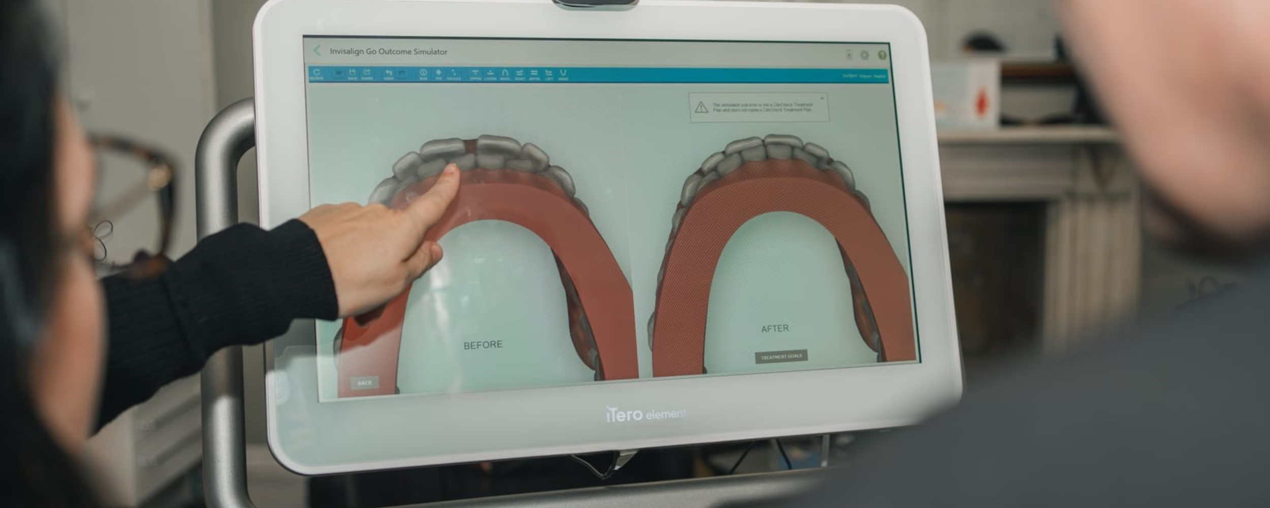 Invisalign® clear aligners
